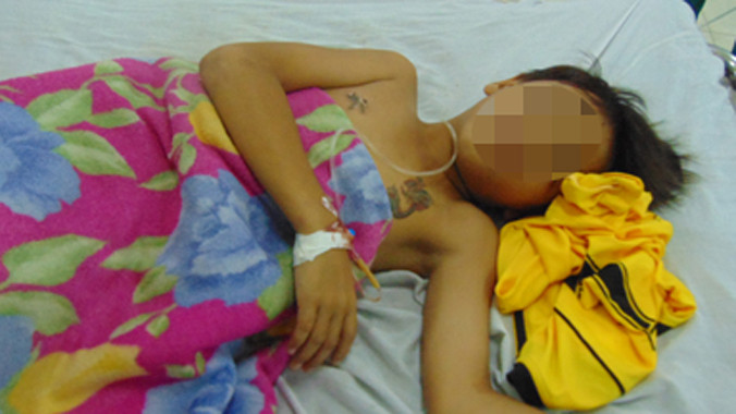 Bé P. may mắn thoát chết.