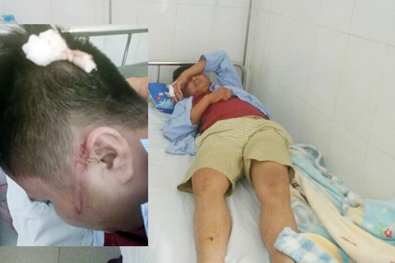 Anh Yên và anh Công nhập viện sau khi bị truy sát.