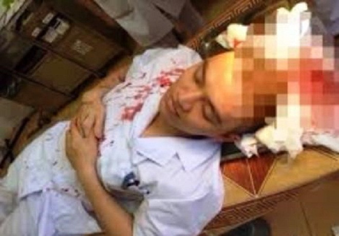 Bị người nhà bệnh nhân hành hung, vị bác sĩ bất tỉnh, phải khâu 7 mũi.