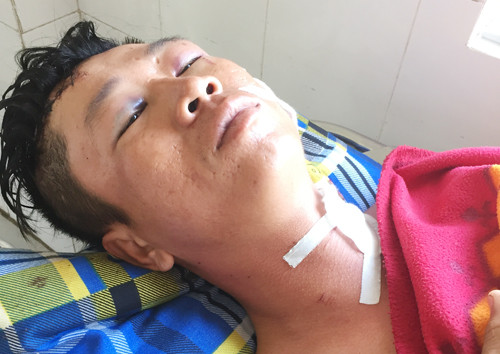 Anh Đợi bị chém nhiều nhát vào người do mời hàng xóm ra khỏi tiệc nhậu