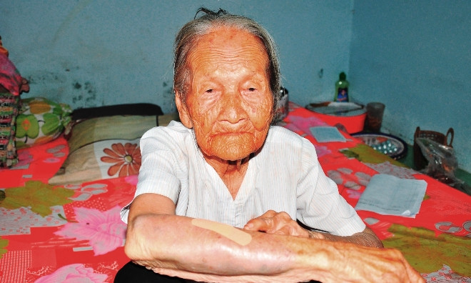 Tay bà Tam còn vết bầm tím