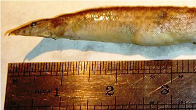 Con lươn trong cổ họng của cậu bé. Nguồn: Daily Mail.