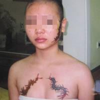 Nạn nhân Giang với 3 hình xăm “quái thú”.