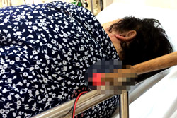 Nạn nhân bị mũi tên ghim vào lưng. Ảnh: Xuân Thắng