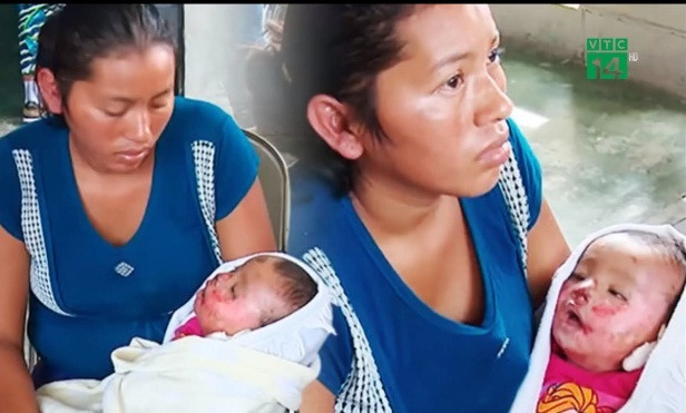 Em bé 7 tháng tuổi được phát hiện còn sống trong đám tang.