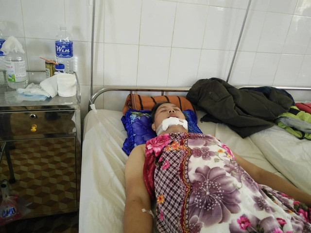 Anh Trung bị đối tượng trộm xe máy tông chấn thương vùng mặt