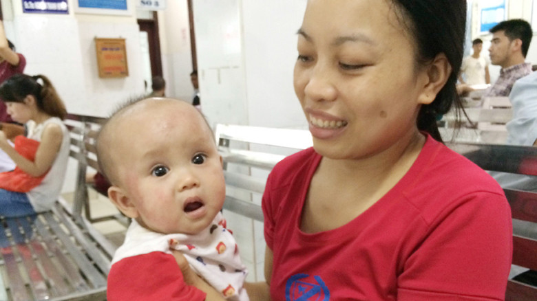  Bệnh nhi Khánh Vy bị viêm da cơ địa. Ảnh T.Hà