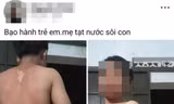 Công an vào cuộc vụ bé trai ở Đắk Lắk nghi bị mẹ tạt nước sôi