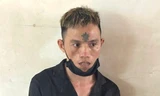 Cô gái bị kề dao vào cổ, cướp điện thoại ở công viên
