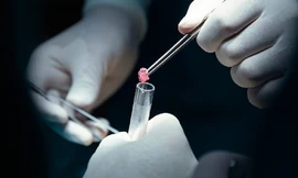 Phát hiện căn bệnh hiếm gặp dễ nhầm với ung thư ở phụ nữ mang thai