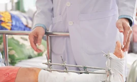 Đứt lìa chân tay vì tai nạn lao động, cảnh báo những sai lầm 'chết người' khi sơ cứu