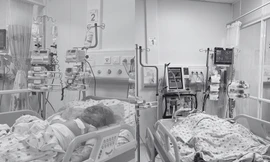 Cha phóng hỏa sau li hôn, 2 con thơ nguy kịch