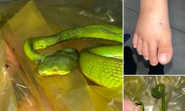 Rắn độc tấn công khiến bé trai nguy kịch 