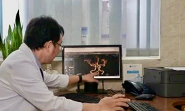 Đột quỵ khi thức giấc, dấu hiệu cảnh báo tuyệt đối không được bỏ qua