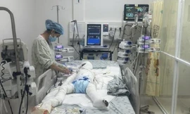 Gần 100 ngày chạy đua với 'tử thần' cứu sống bé trai bị cha phóng hỏa sau ly hôn