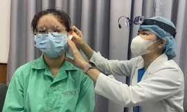 Bị vỡ xương thái dương, suýt điếc vĩnh viễn vì… ngoáy tai