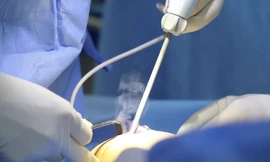 Cô gái trẻ suýt mất 'gò bồng đảo' vì tiêm chất làm đầy