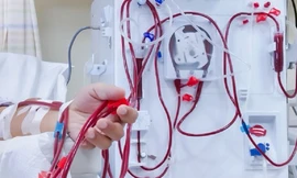 Bệnh thận đang âm thầm tấn công người trẻ