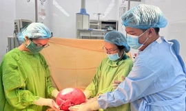 Giải cứu người phụ nữ 'mang bầu' suốt 10 năm