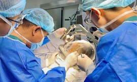 Đặt điện cực não sâu cứu thiếu nữ bị động kinh kháng thuốc