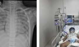 TPHCM: Liên tục xảy ra sự cố trẻ bị đuối nước ngay tại hồ bơi