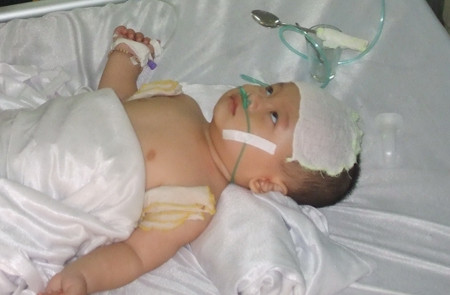 Cháu Lâm Nguyễn Huỳnh thường xuyên bị co giật