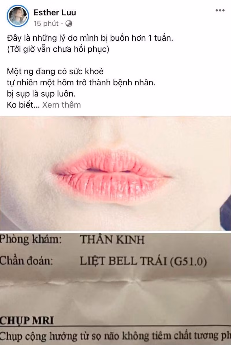 Hari Won chia sẻ về căn bệnh bản thân đang mắc phải. - Ảnh: FBNV