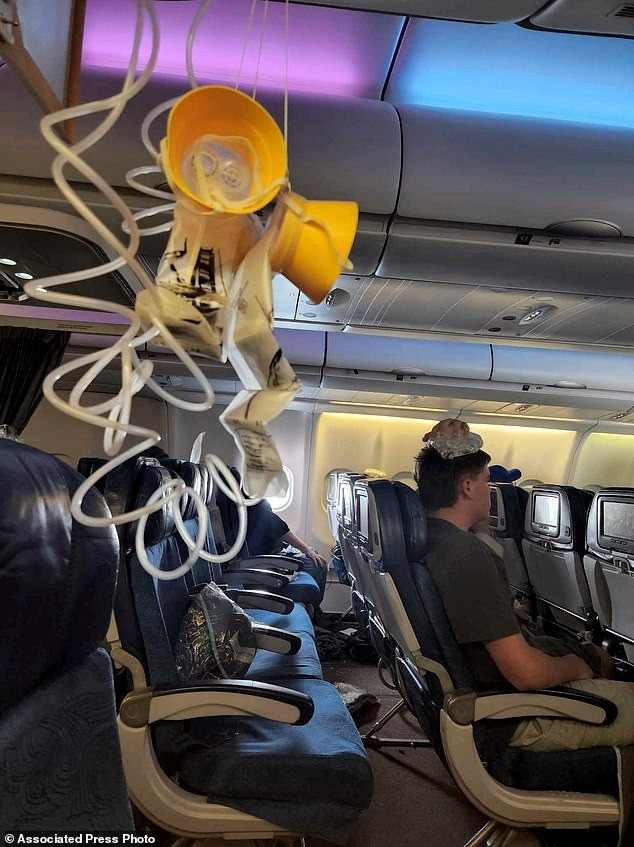 Bức ảnh do một hành khách cung cấp cho thấy mặt nạ dưỡng khí bị rơi và một người đàn ông bị thương đang phải chườm nước đá trên đầu.