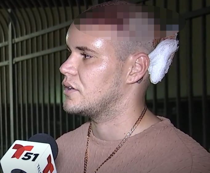 Khách Eugenio Ernesto Hernandez Garnier vừa trải qua ca phẫu thuật cấy tóc khiến đầu anh ta liên tục rỉ máu. Ảnh chụp màn hình.