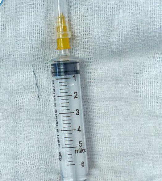 Sợi thép nhỏ nhưng rất cứng và nhọn 2 đầu, dài 2cm