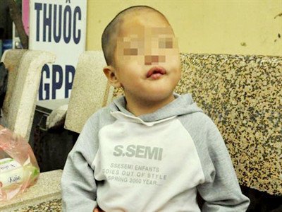 Do quá túng quẫn nên bố mẹ cháu Hạnh đã phải đưa con mình đi nương nhờ cửa phật