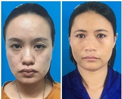 Phát hiện đường dây phụ nữ mua bán bào thai ở Quảng Ninh ảnh 1