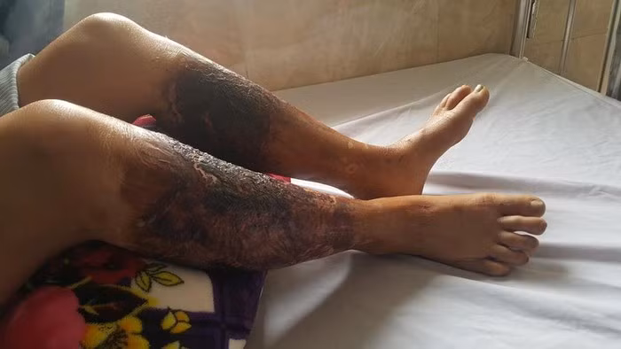Xác định nghi phạm đổ chất thải độc hại ra mương nước khiến cây cỏ chết cháy ảnh 3