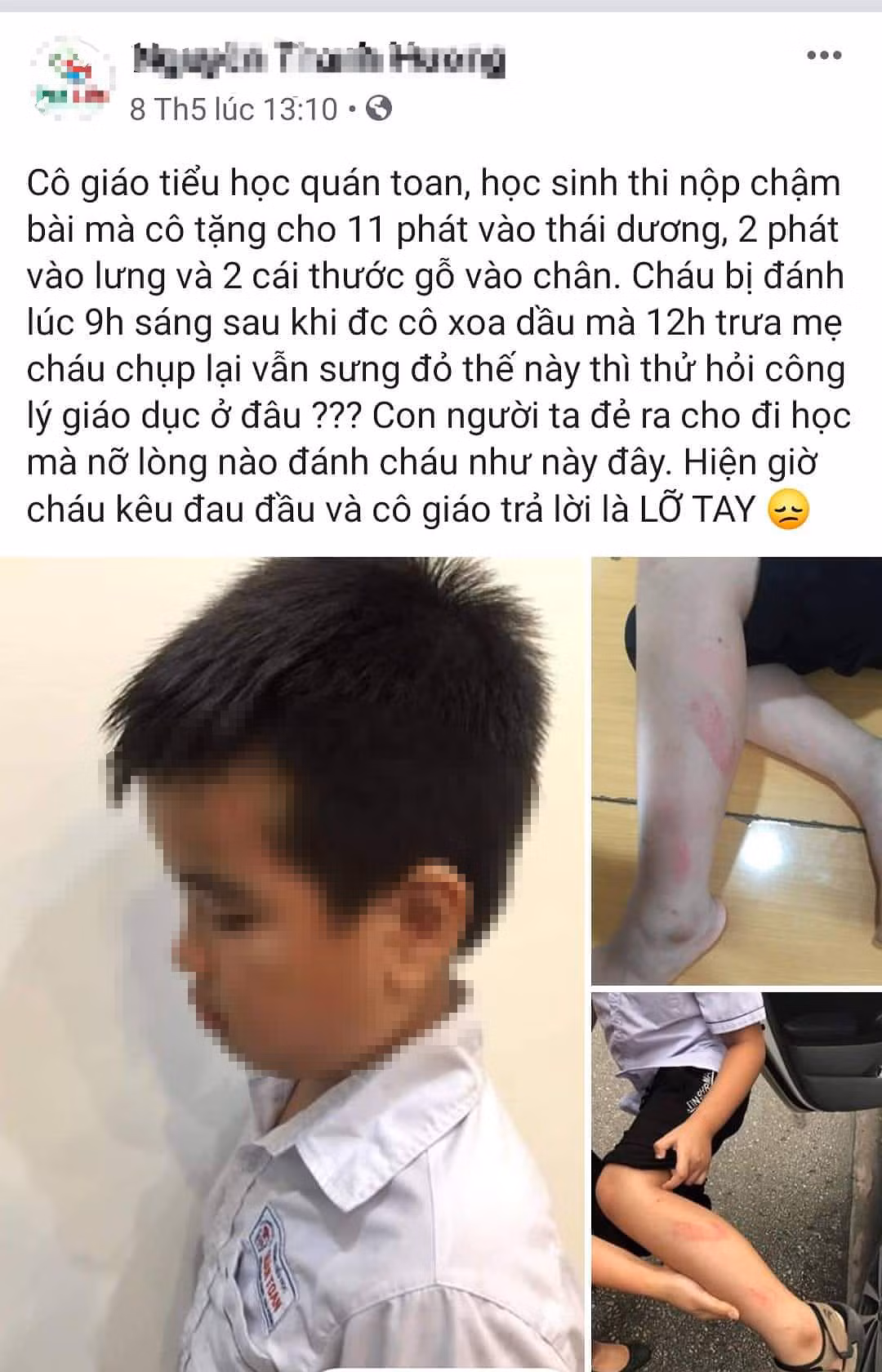 Đình chỉ công tác cô giáo Hải Phòng vụt học sinh lớp 2 đỏ chân ảnh 1