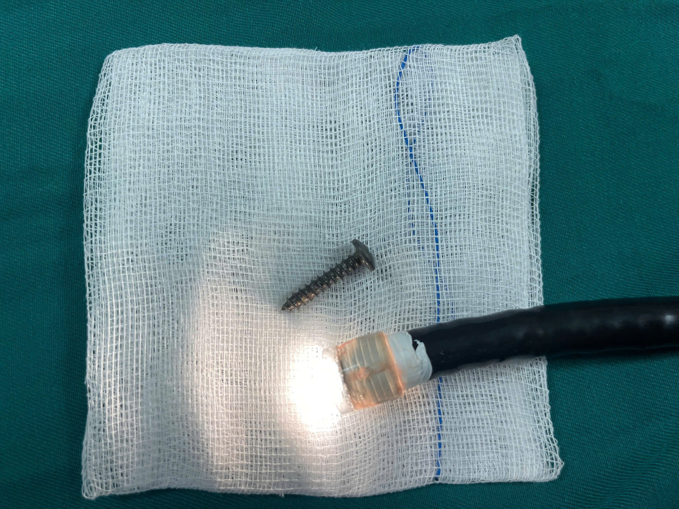 Dị vật đã được các bác sĩ của Bệnh viện Đa khoa tỉnh Quảng Trị lấy ra thông qua phương pháp nội soi bằng ống soi mềm.