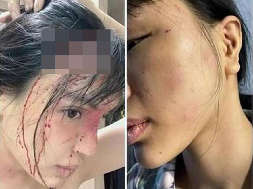 Công an điều tra vụ người mẫu bị đánh. Công an điều tra vụ người mẫu bị đánh.