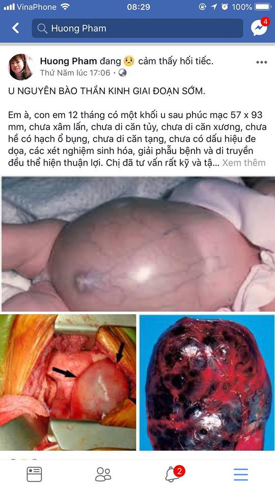 Bác sỹ 'kêu cứu' vì mẹ bệnh nhi ung thư từ chối điều trị cứu con ảnh 1