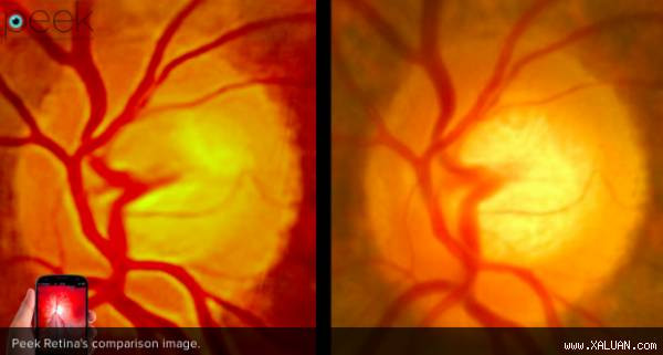 Ứng dụng khám mắt trên điện thoại smartphone