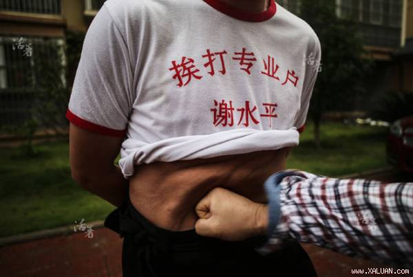  Phần da bụng biến dạng nhưng ông Xie vẫn không hề hấn gì sau cú đấm trời giáng.