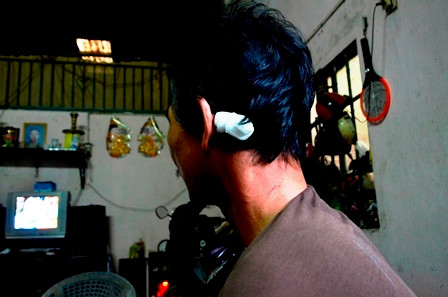 Anh Nam với vết thương ở vùng đầu