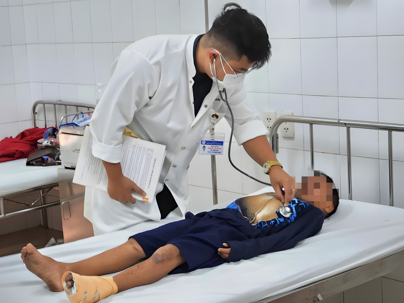 Một bệnh nhi cấp cứu, điều trị tại Bệnh viện T.Ư Huế do bị bỏng nặng sau khi nghịch pháo nổ. Ảnh: M. Trang