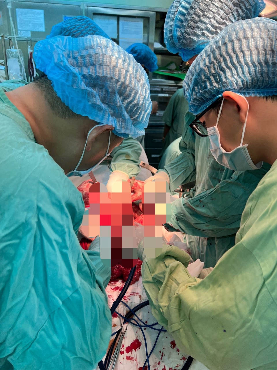 Các y, bác sĩ Bệnh viện T.Ư Huế mổ cấp cứu cho bệnh nhân V.Đ.D. Các y, bác sĩ Bệnh viện T.Ư Huế mổ cấp cứu cho bệnh nhân V.Đ.D.