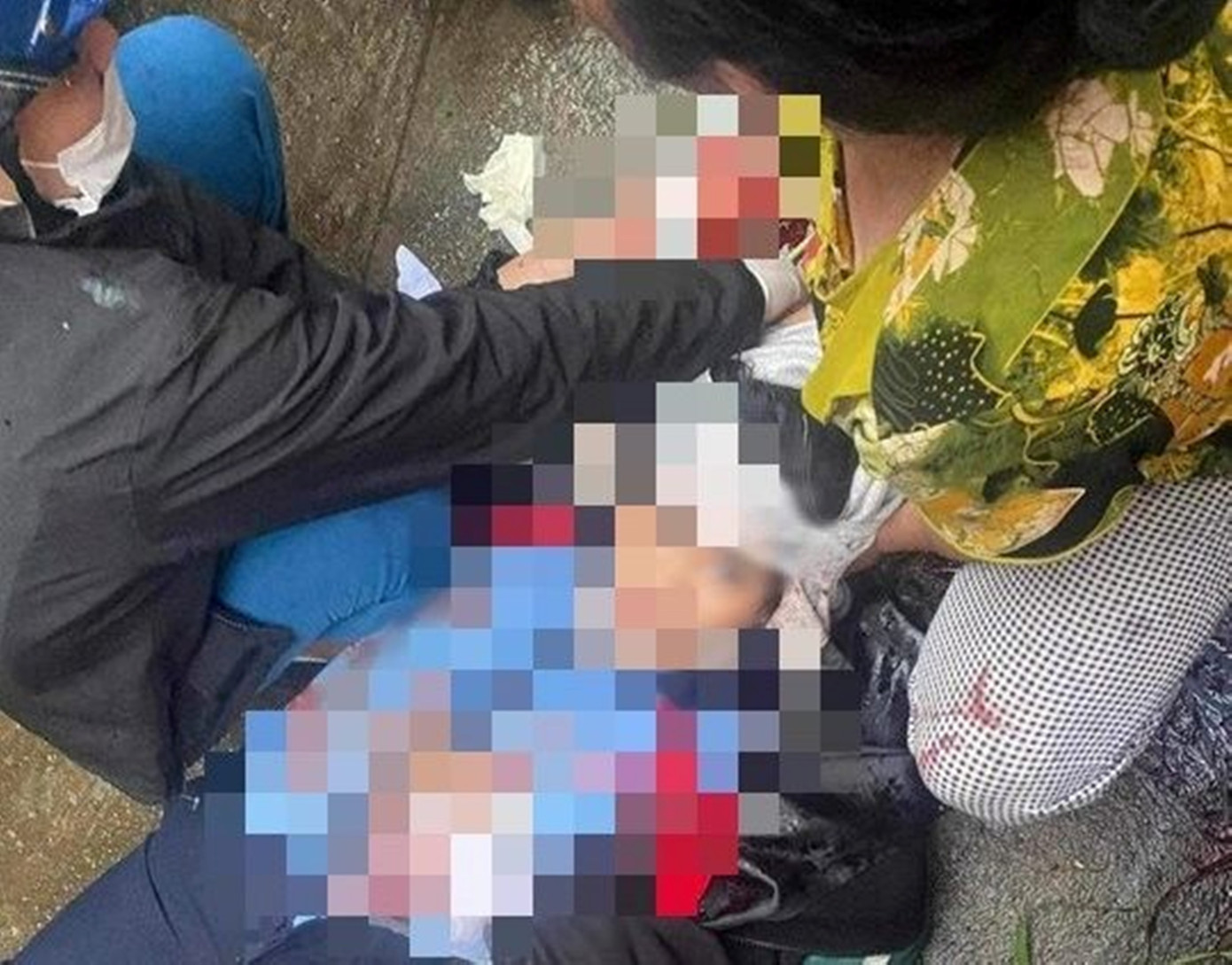 Em Nh. bị hàng xóm tấn công bằng búa gây thương tích nặng. (Ảnh: Tám Quang) Em Nh. bị hàng xóm tấn công bằng búa gây thương tích nặng. (Ảnh: Tám Quang)