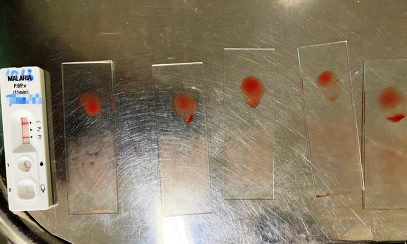 Làm test chẩn đoán nhanh và lấy máu soi lam cho bệnh nhân tại CDC TT-Huế. Ảnh: CDC