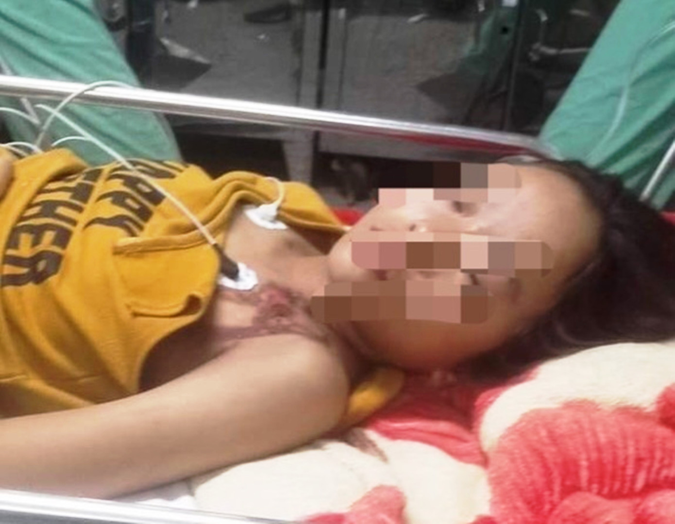 Một học sinh lớp 5 bị sét đánh trúng thời điểm xảy ra dông lốc phải nhập viện cấp cứu.