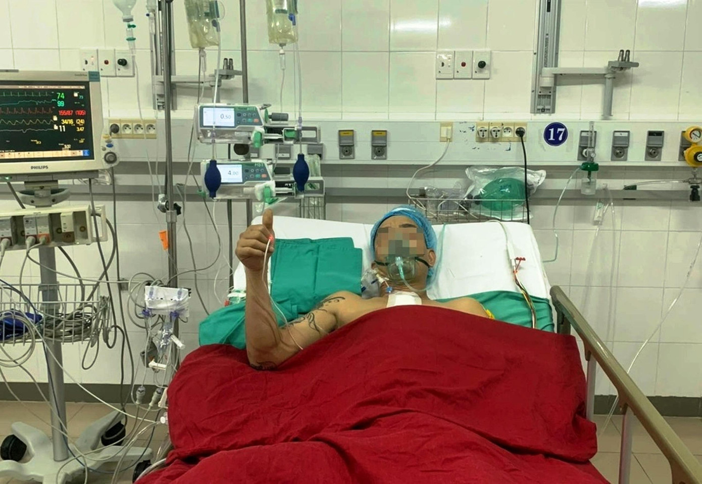 Bệnh nhân nhận tạng hồi phục nhanh sau ca ghép