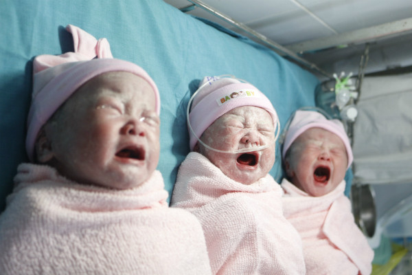 Sản phụ sinh ba bé gái đều cân nặng trên 2,5 kg ảnh 1