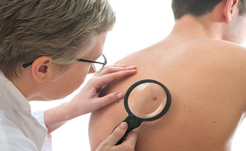 Ảnh minh họa:Health. ung-thu-da-7777-1440172898.jpg