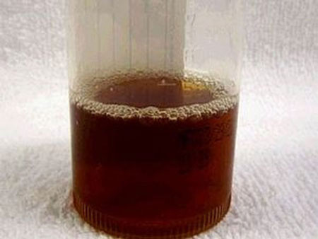 7 dấu hiệu không hề đau đớn nhưng khiến bạn dễ chết sớm ảnh 1