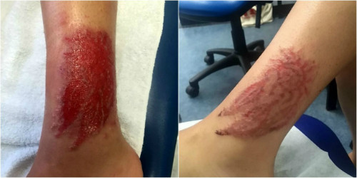 gallery-1439913910-black-henna-4579-3053